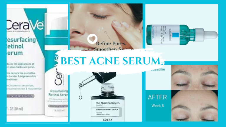 Best Serum for Acne