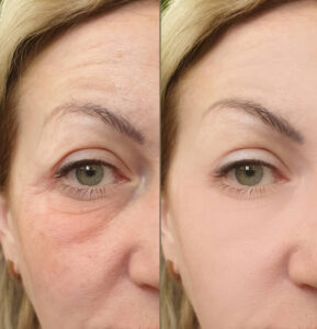 Anti Ageing Serums